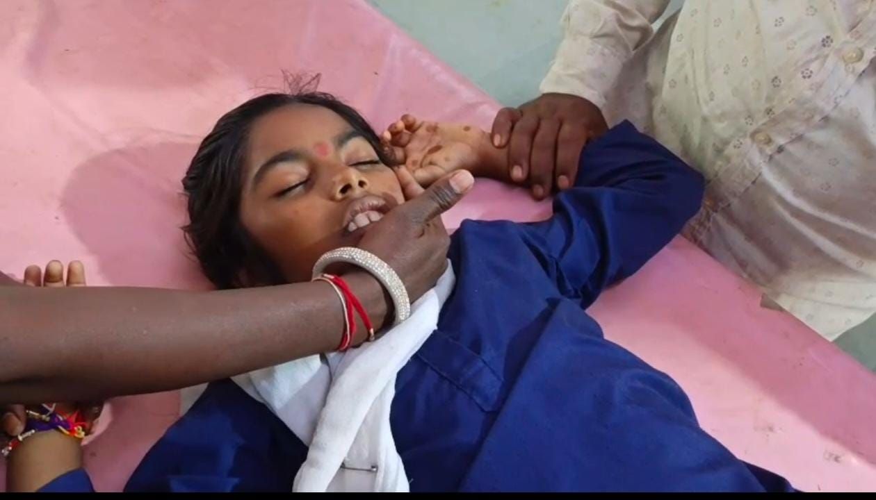 नालछा कन्या स्कूल में भारी लोहे का गेट गिरा, सातवीं की छात्रा गंभीरघायल  पैर में 10 सेअधिक टांके, जिलाअस्पताल में भर्ती 