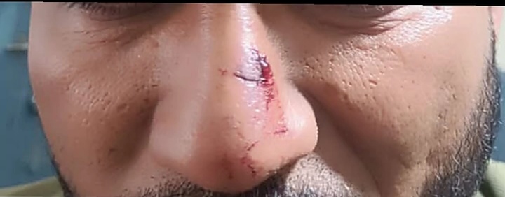 बदनावर ट्रैक्टर शोरूम कर्मचारी को किश्त नहीं भरने पर बजाज फाइनेंस कंपनी के वसूली करने वाले गुर्गो  ने पीटा पुलिस ने मामला दर्ज कर आरोपियों की तलाश जारी